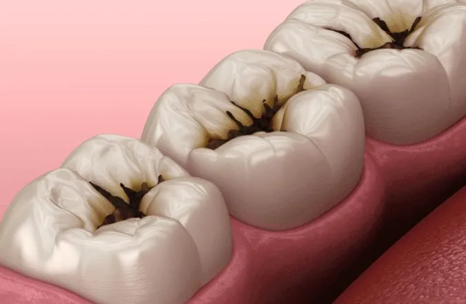 placeholder-landscape